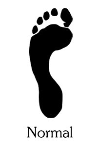 Normal footprint
