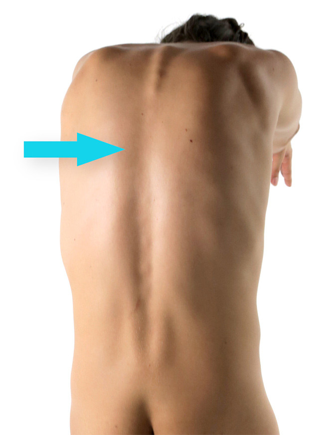 7th Cervical of the Spine