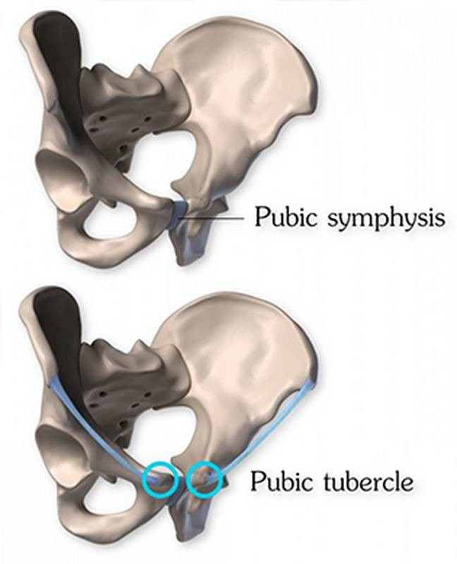 publis pubic synthesis pubic tubercle