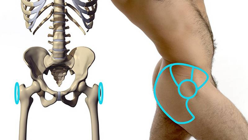 bony protrusion on the side of the hip
