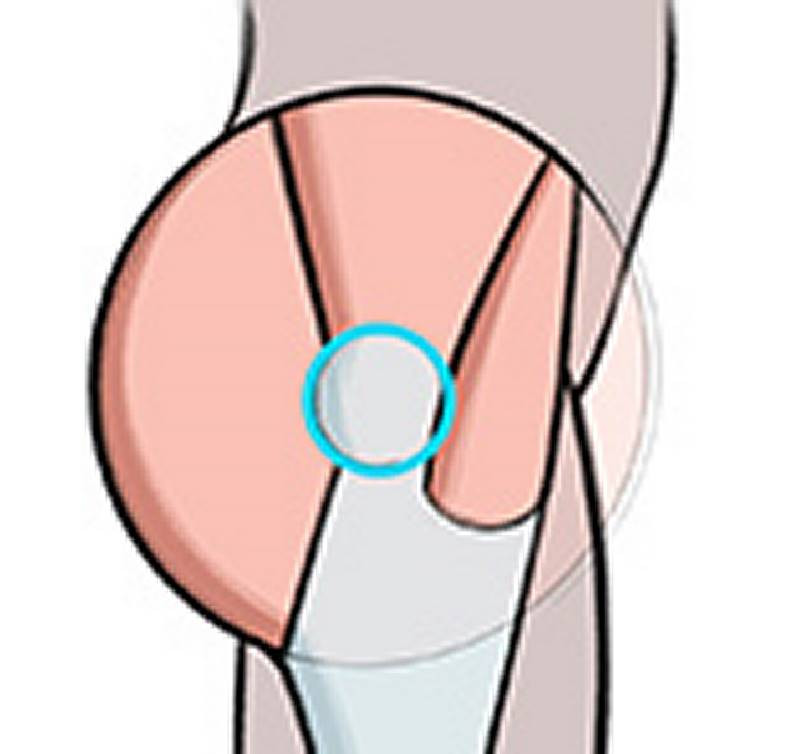 butt muscles surrounding the great trochanter