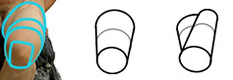 combination of basic forms