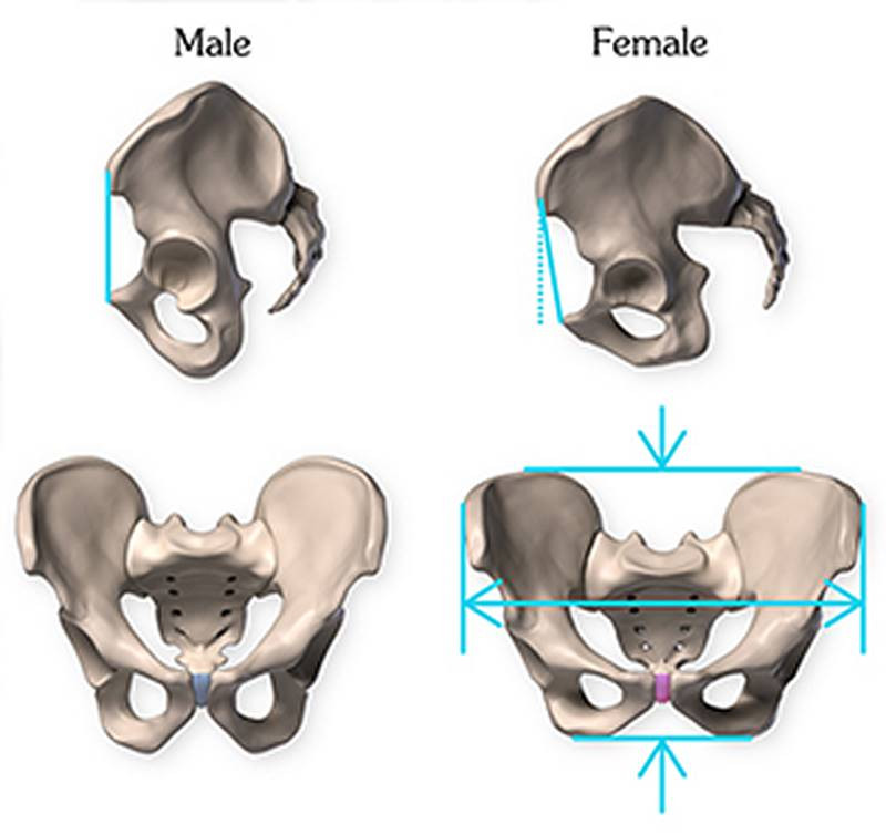 male female pelvis dismophism
