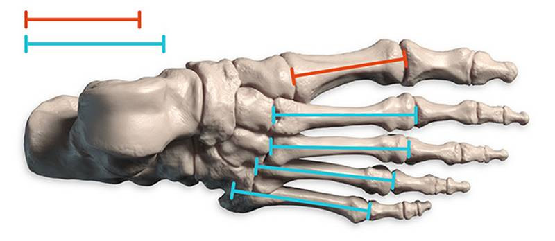 metatarsal length