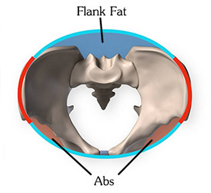 pelvis flank fat abs