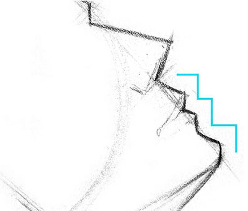 staircase of major planes