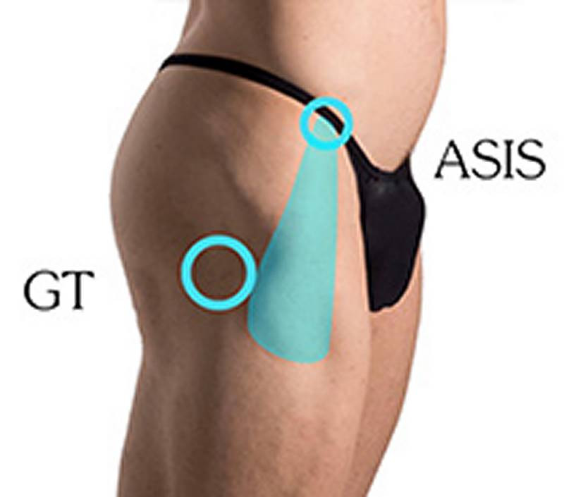 Attachments of the tensor fasciae latae