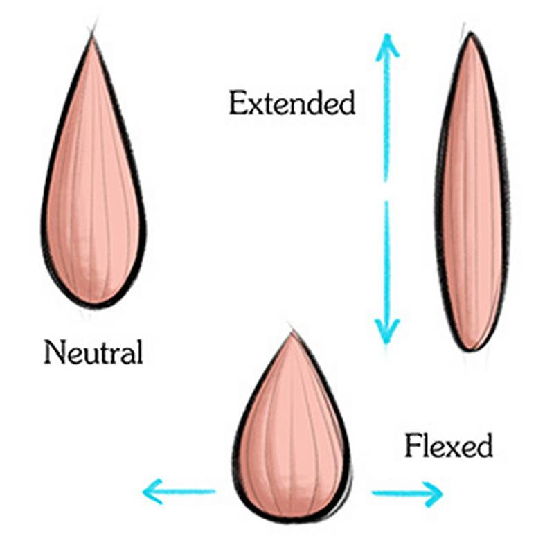 Shape of the tensor fasciae latae