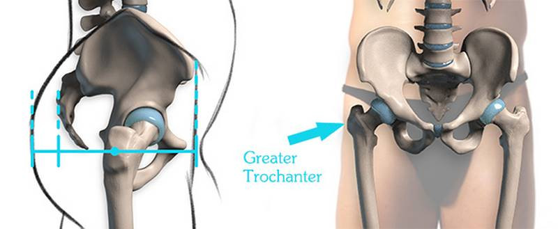 trochanter diagram labeled final
